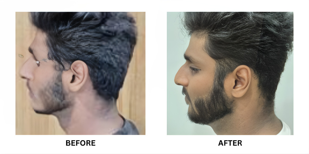 Before and after orthodontic treatment: plate 53 of 53 from the practice’s own record, the patient before treatment on the left and after treatment on the right.