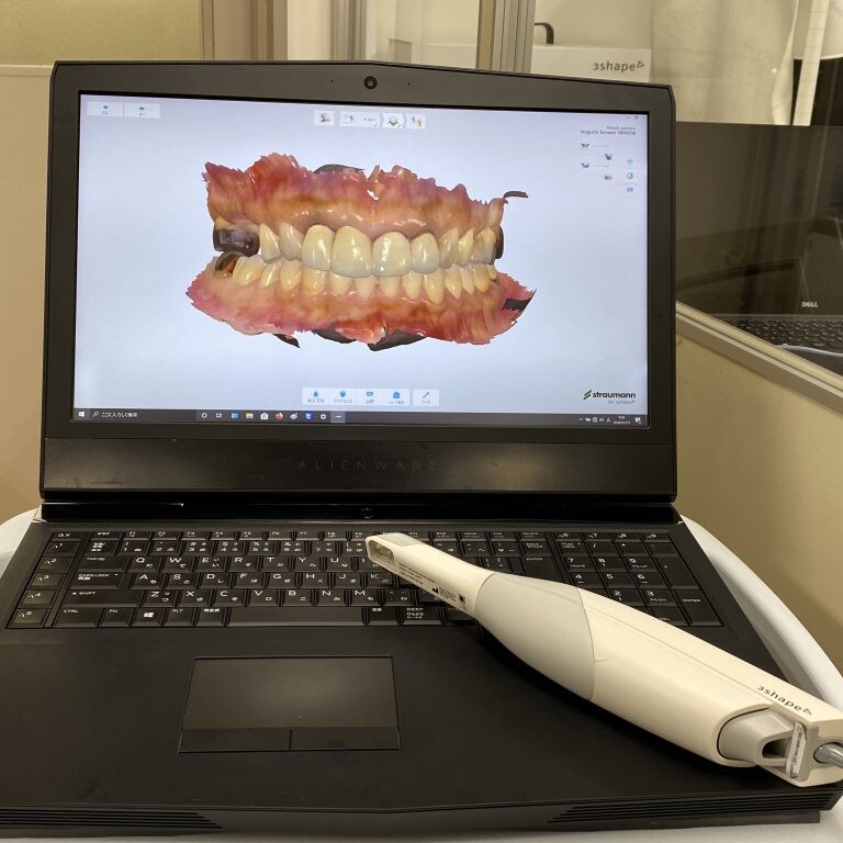 An intraoral scanner wand resting on a laptop at the practice, the screen showing the three-dimensional scan of a patient’s upper and lower teeth it has just taken.