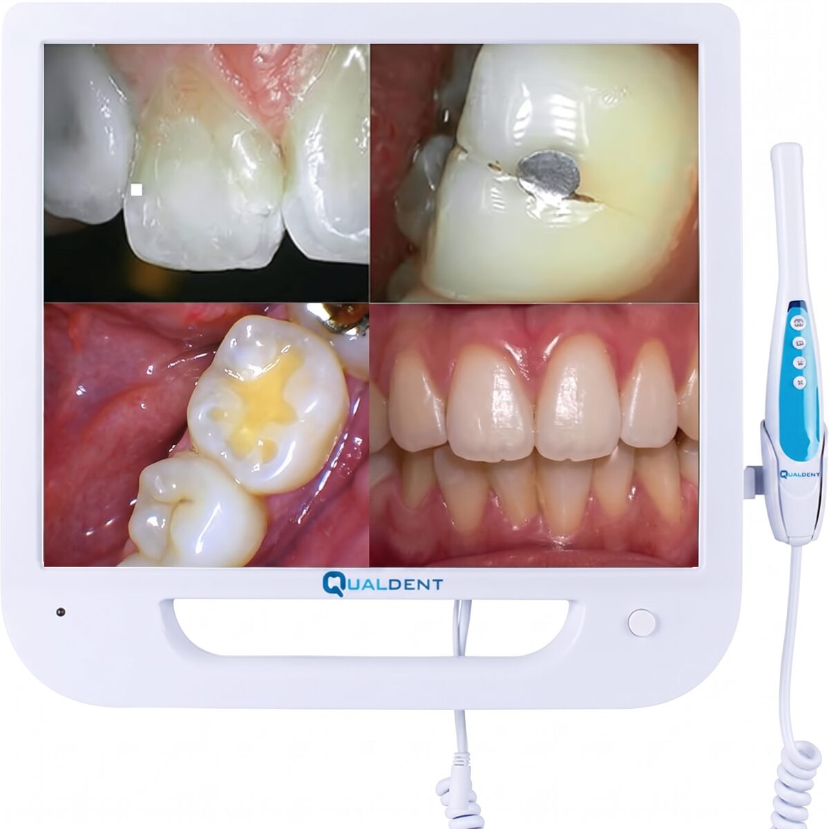 A dental intraoral camera: a slim handheld wand resting in its cradle beside a clinical display screen showing a close view of teeth and gums.