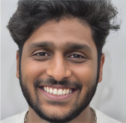 The same young man smiling after treatment, the upper and lower front teeth in line.