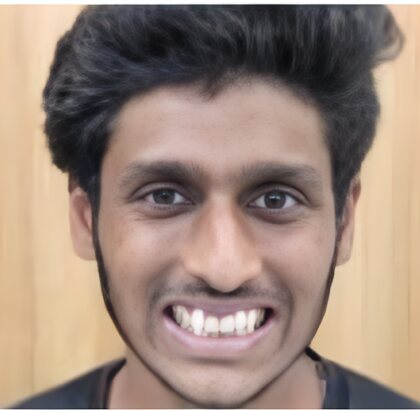A young man smiling before orthodontic treatment, his upper front teeth crowded and pushed forward.