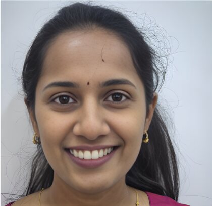 The same young woman smiling after treatment.