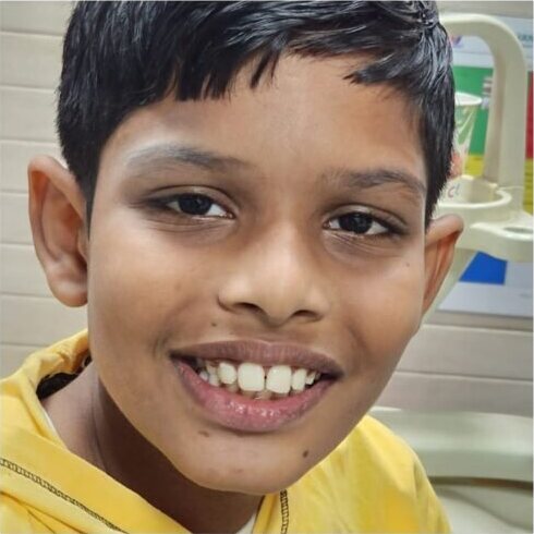 The same boy smiling in the surgery on another visit.