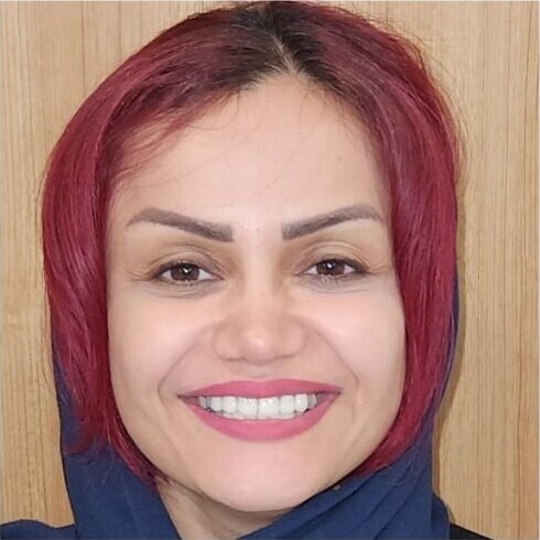 The same face after treatment, the upper front teeth even and lighter.
