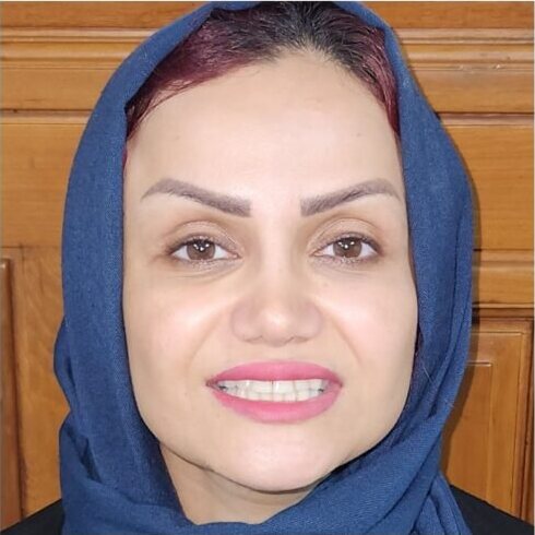 A woman's face before smile makeover treatment, her upper front teeth worn and discoloured.
