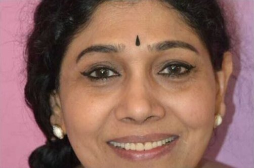 The same smile after treatment, the upper front teeth even and lighter.