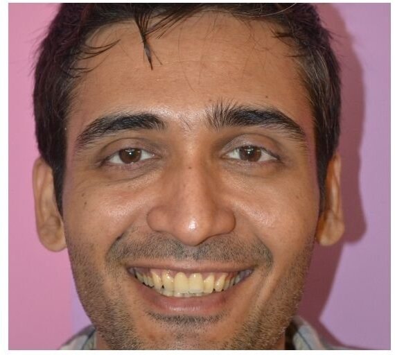 The same smile after treatment.