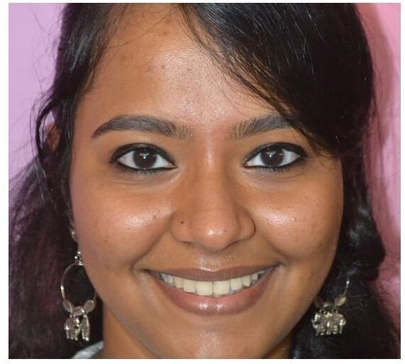 The same smile after treatment.