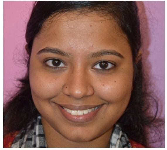 A young woman's smile before treatment.